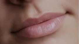Close-up of smooth, hydrated lips with a glossy finish, showcasing the results of effective Treatments for Lip Lines