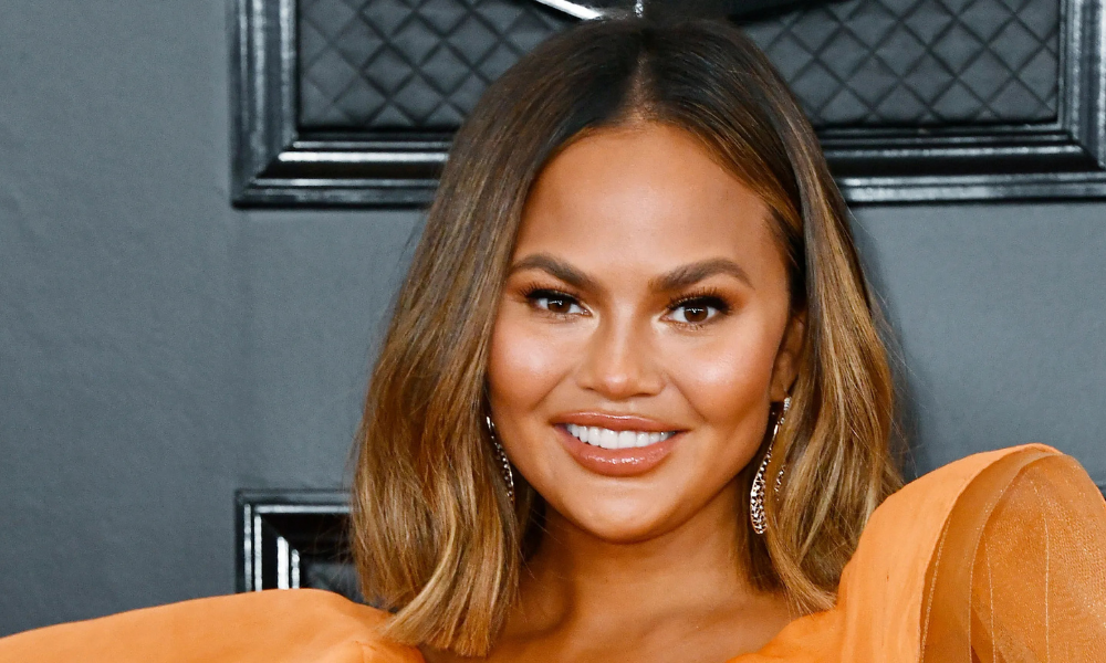 Chrissy Teigen smiling after losing a dental veneer during a holiday Instagram moment